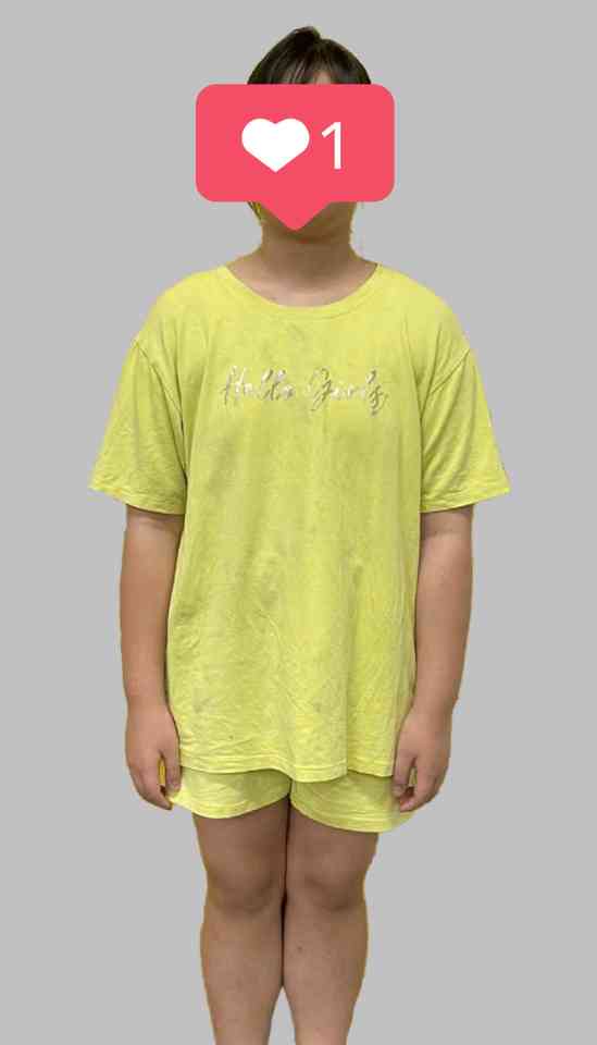 Bé gái béo phì trước khi tham gia chương trình tập luyện tại Live Fit Kid