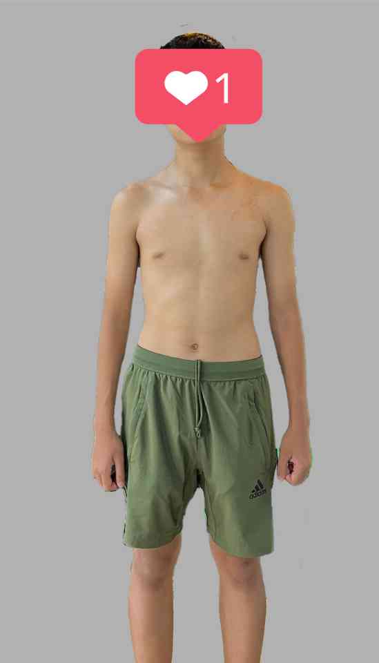 Bé trai gầy trước khi tham gia chương trình tập luyện tại Live Fit Kid